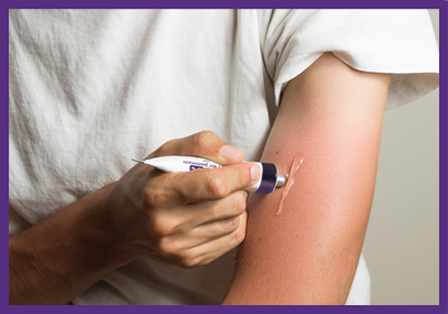 A person applying Xylocaine 5% Ointment on their skin